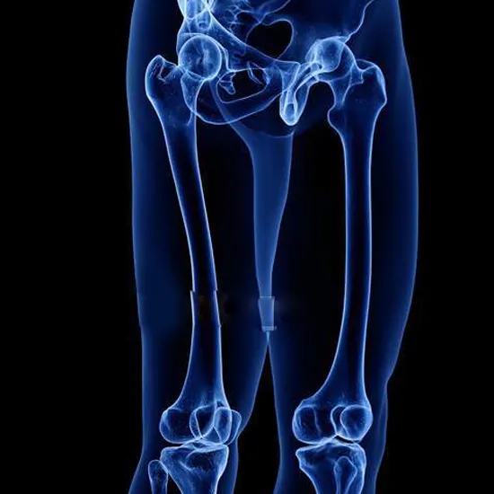 X-Ray Upper Thigh